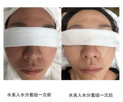 皮膚管理與生活美容 專(zhuān)業(yè)差異與生活服務(wù)